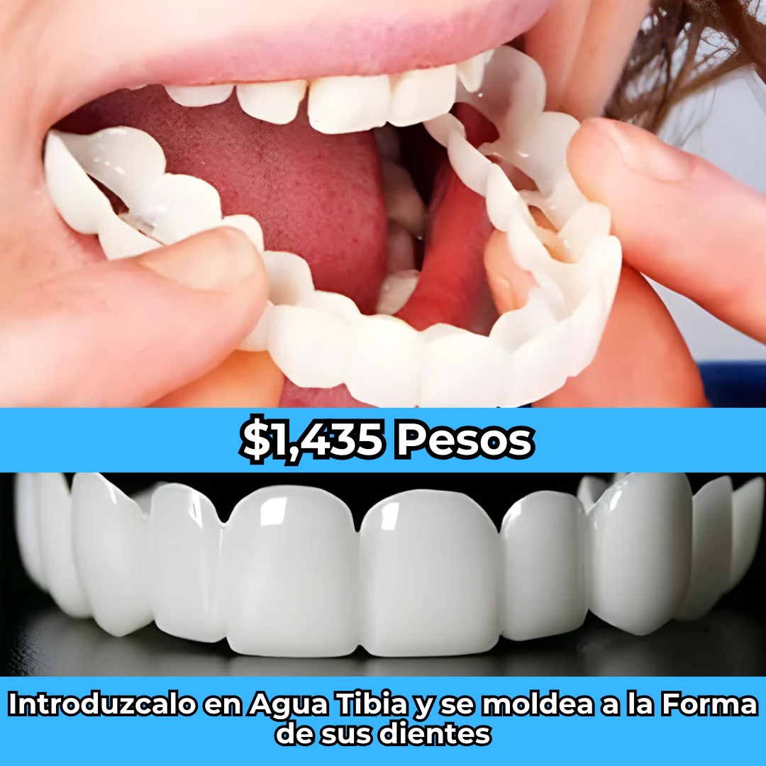 PerfectSmile™ - No Pases Mas Verguenza