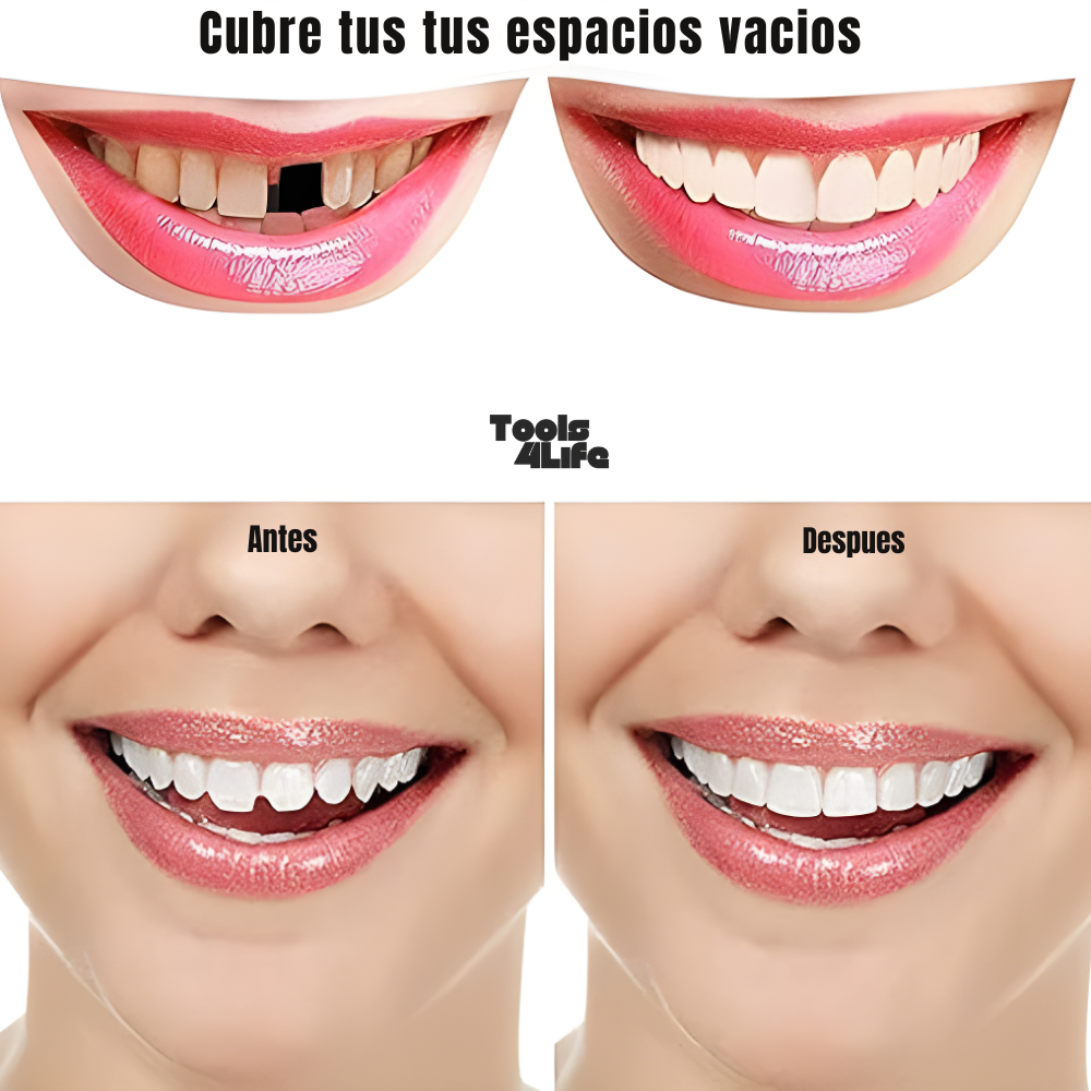 PerfectSmile™ - No Pases Mas Verguenza